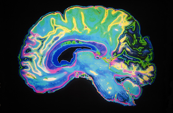 fMRI scan of a brain
